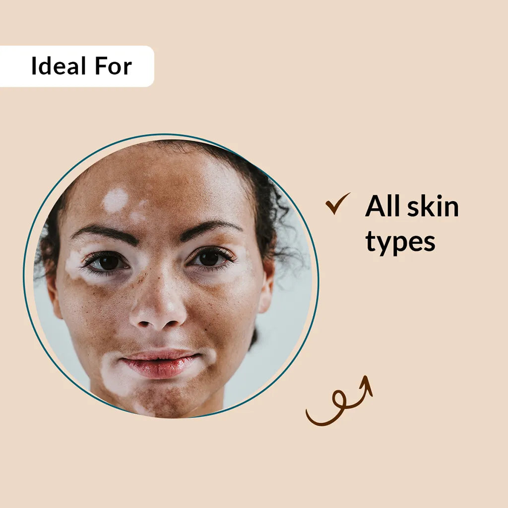 Vitipause Gel, 15 ml | A pigment-regulating formula to improve Vitiligo concerns