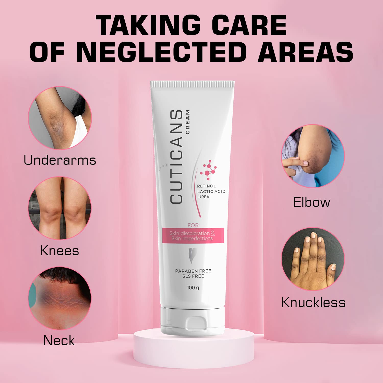 Cuticans Cream For Acanthosis Nigricans, Skin Discoloration & Skin Imperfections | 100g - Skiynse Dermatologique