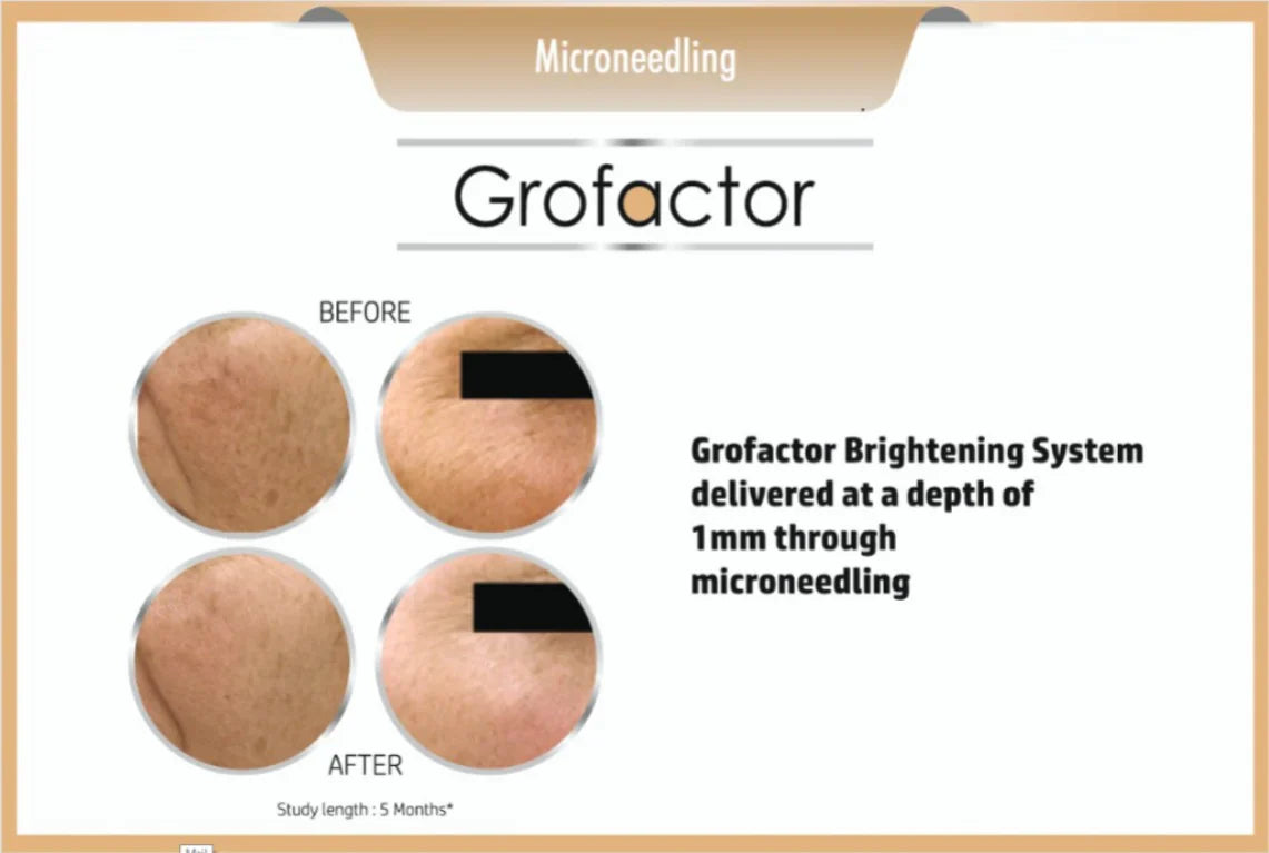 Grofactor Brightening System- 4ml