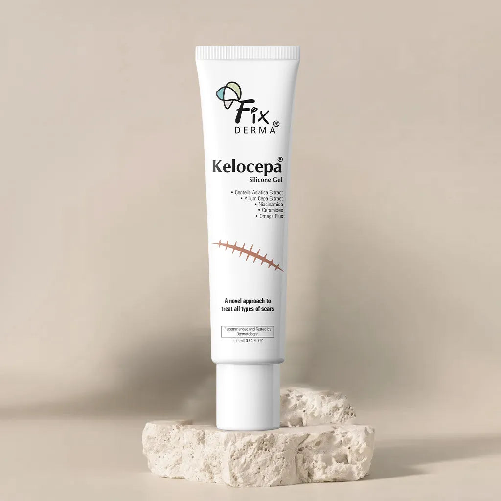 Kelocepa Silicone Gel, 25 ml | Treats and Heals All Types of Scars