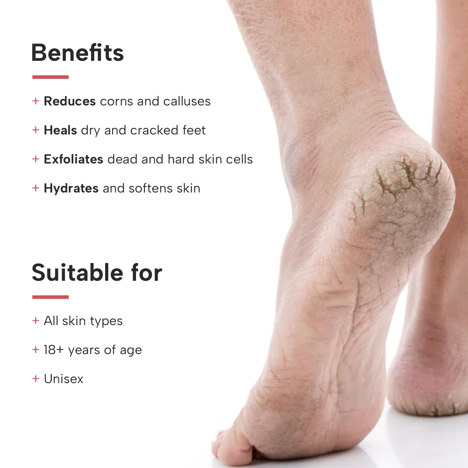 DERMATOUCH Xero Cream | Specially for Dry & Cracked Feet | Soothes & Moisturizes |For Corns & Calluses| For both Men & Women ( Pack of 2 )